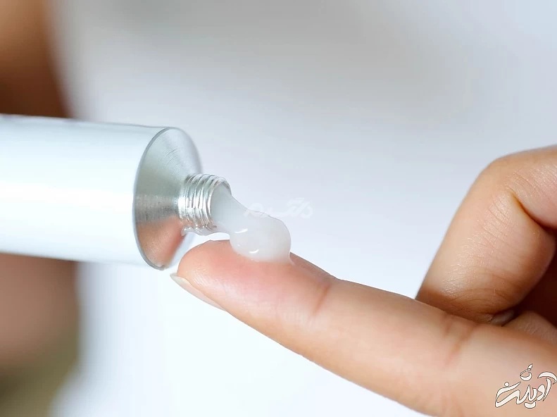 کرم کورتیکواستروئیدی